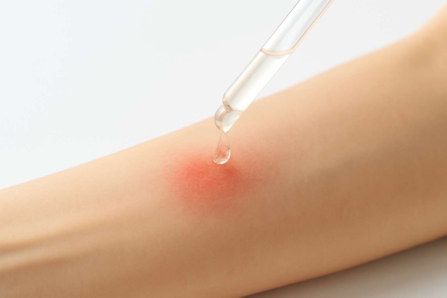 Think twice: can skin products burn your skin and how to protect ...